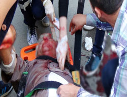 Karsta Trafik Kazası: 1 Yaralı