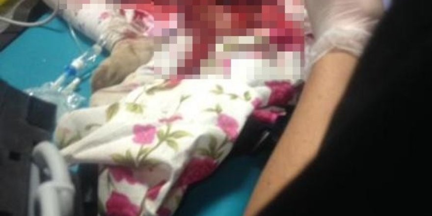 Kars'ta patos makinesine düşen kız çocuğu ağır yaralandı