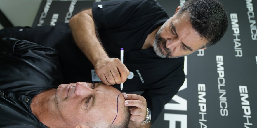 "Comfort and Care: Embracing Painless Hair Transplant Procedures"