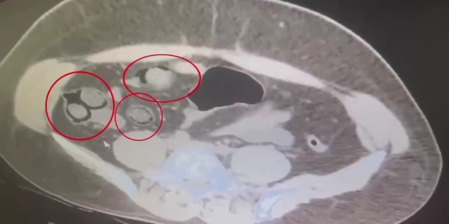 Kars'ta uyuşturucu kuryeliği yapan İran Uyruklu şahıs yakalandı