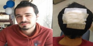 KAÜ Araştırma Görevlisi Darp Edildi