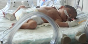 Öldürülen annesinin karnından alınan bebek Erzurum’da tedavi altında