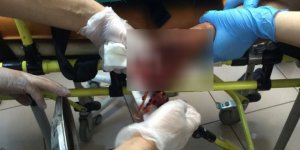 Kars’ta elinde torpil patlayan çocuk yaralandı