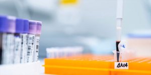 AkgenLab: Genetik Biliminin Gücünü Keşfedin