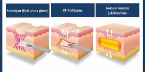 İz Kalmadan Sivilce Tedavisi Mümkün mü? Ne Zaman Müdahale Edilmeli?